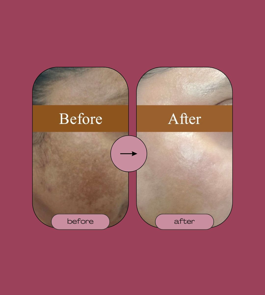 Singhar Whitening Cream for Dark Spots & Radiant Skin – 50ml