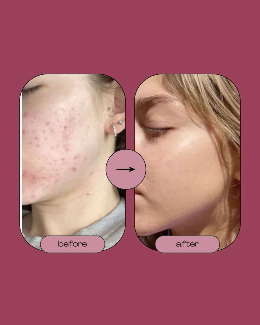 Singhar All-in-One Whitening Serum