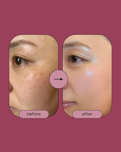 Singhar Whitening Serum