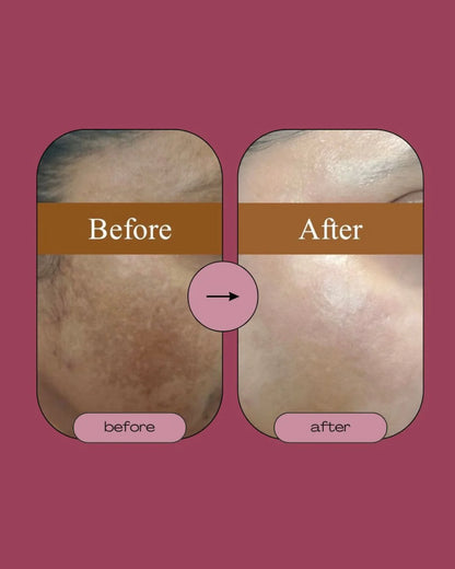 Singhar Whitening Cream – 50ml