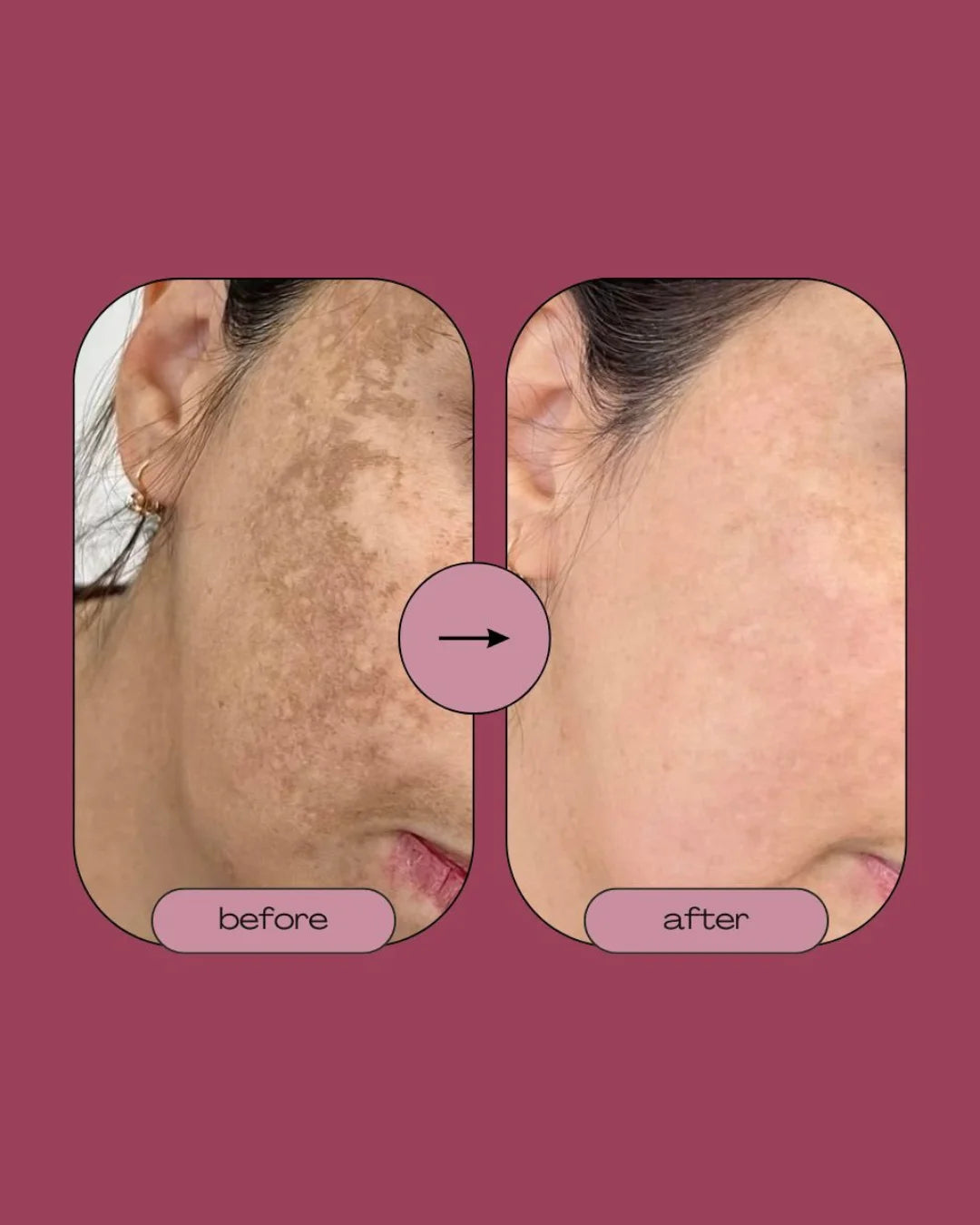 Singhar Sunblock Moisturizer