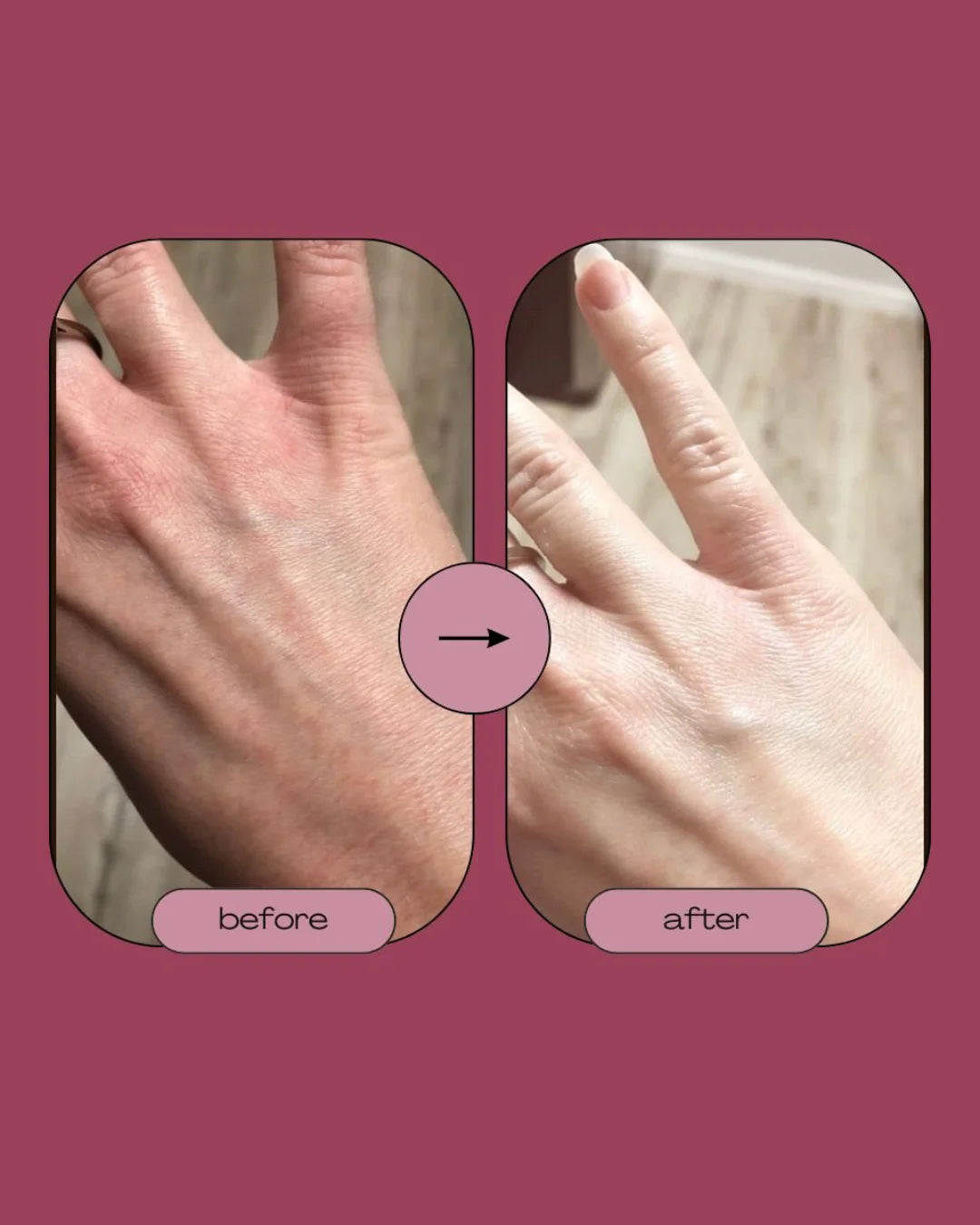 Singhar Hand & Feet Whitening Cream