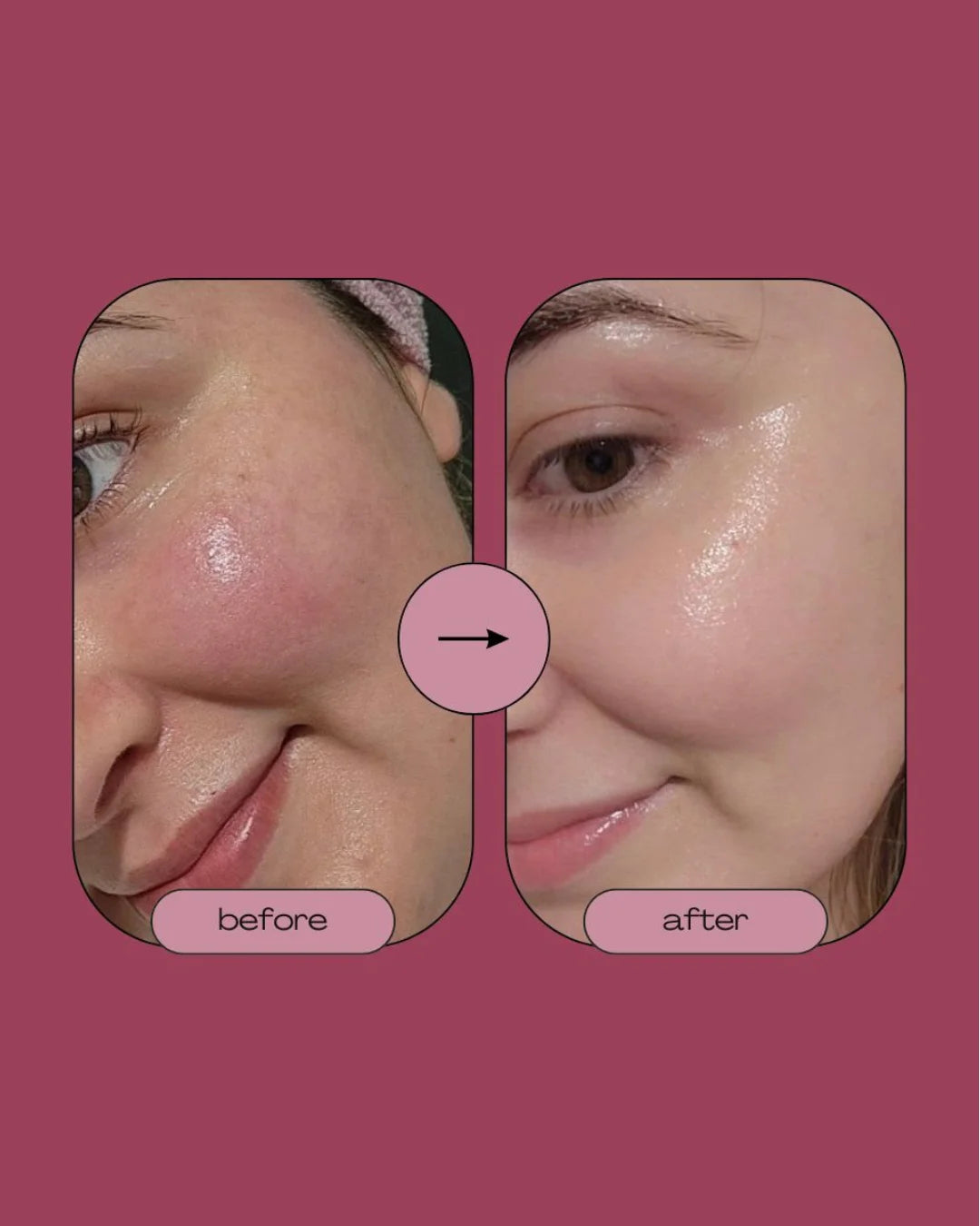 Singhar Creamy Facewash
